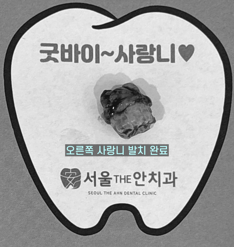 치아 모양의 종이 위에 발치된 오른쪽 사랑니가 놓여 있고 '굿바이~사랑니' 문구가 있는 사진