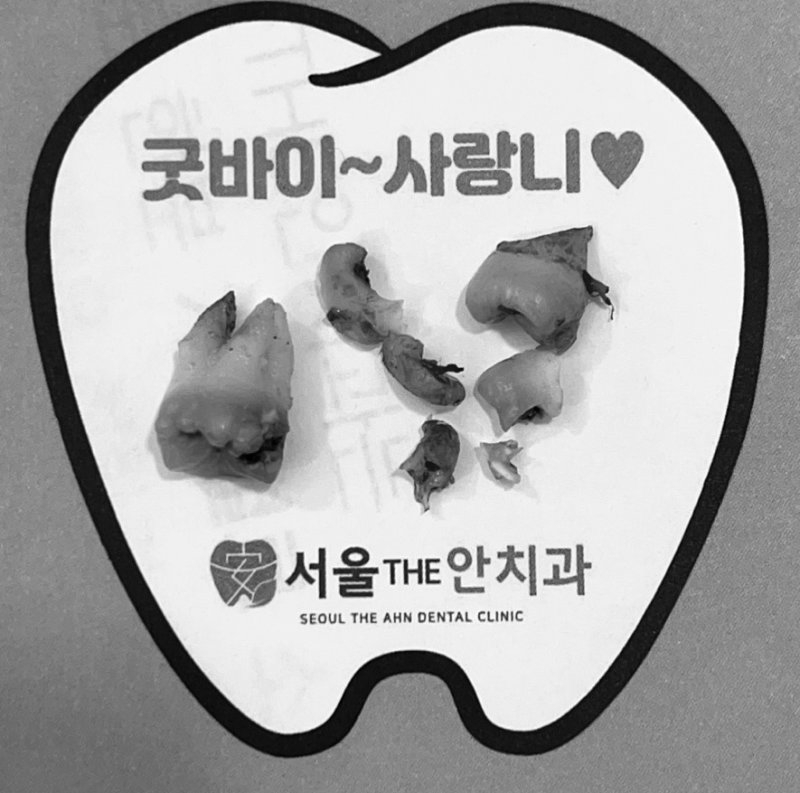 발치된 사랑니와 치아 조각들이 놓인 '굿바이~사랑니' 문구가 있는 종이